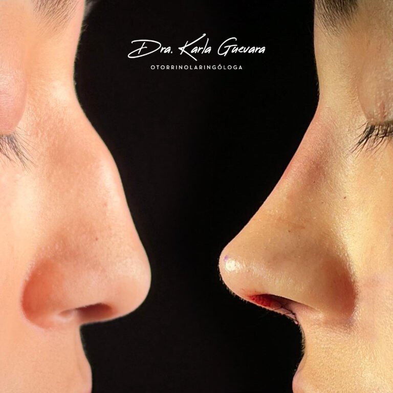 Post Orl Karla Guevara copia