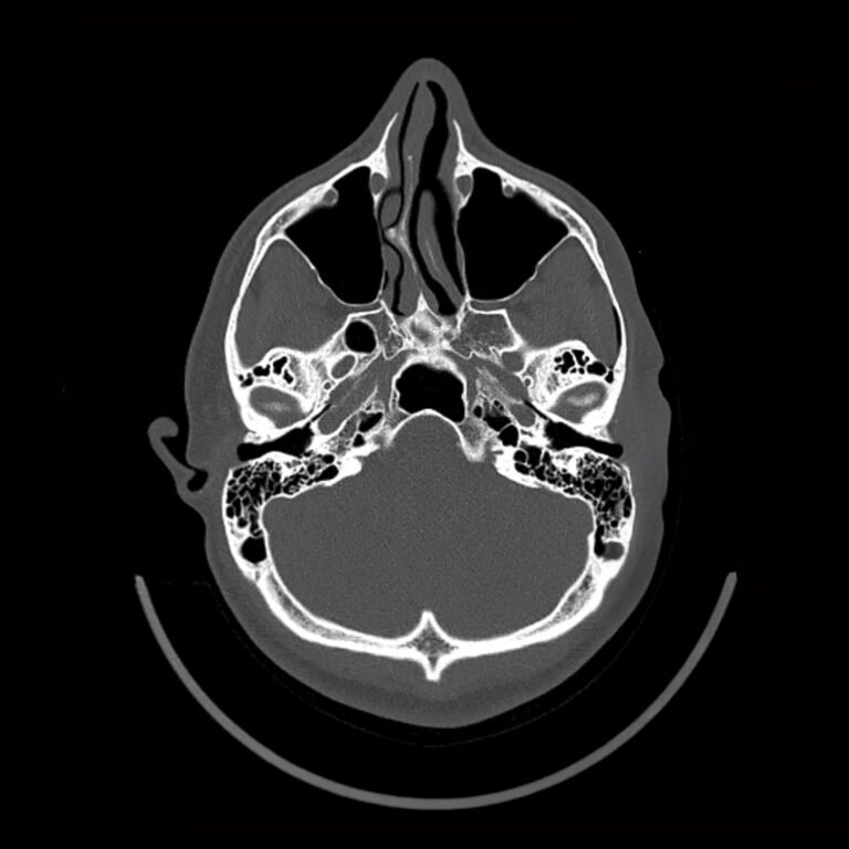 Post Orl Karla Guevara copia