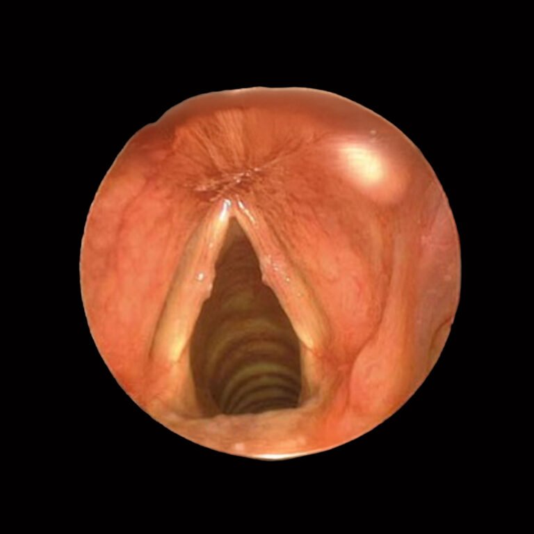 Post Orl Karla Guevara copia