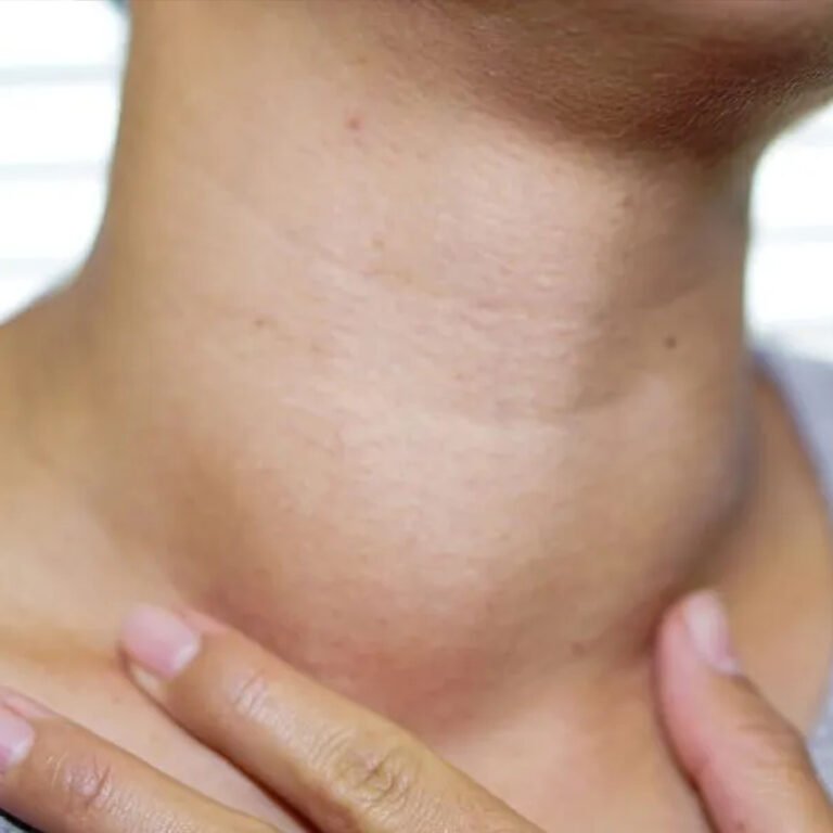 Post Orl Karla Guevara copia