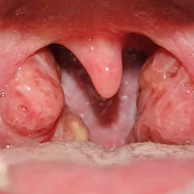 Post Orl Karla Guevara copia