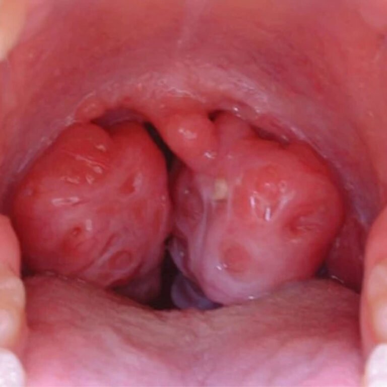 Post Orl Karla Guevara copia