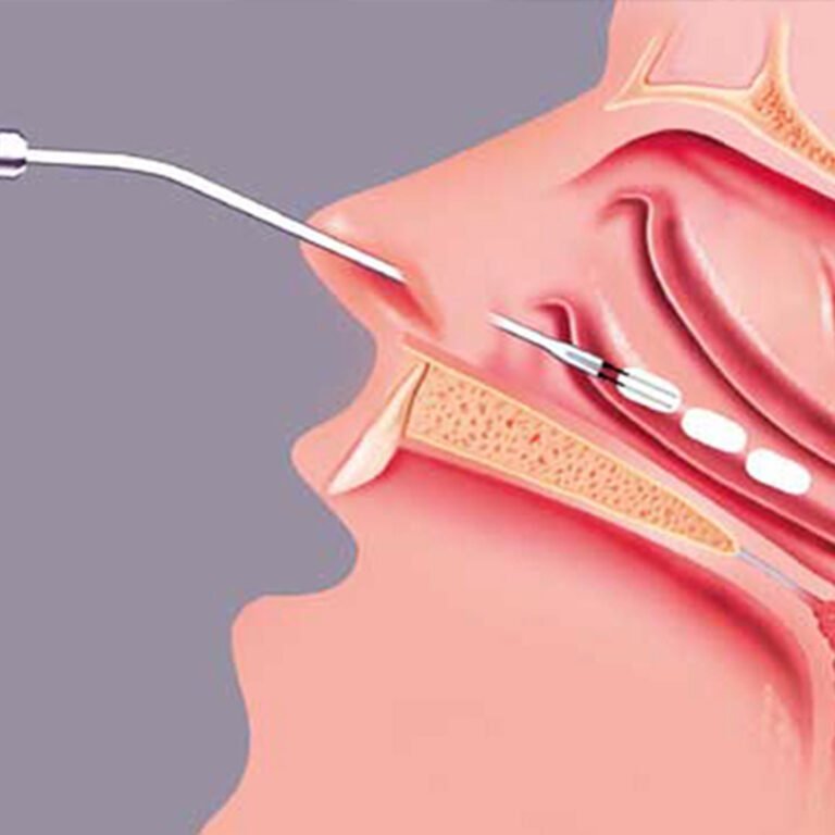 Post Orl Karla Guevara copia