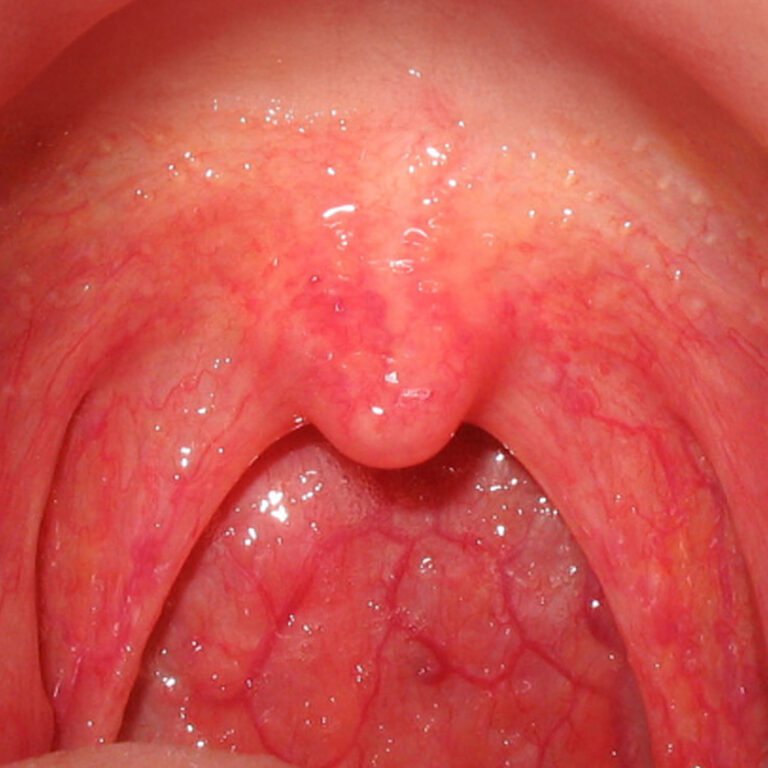 Post Orl Karla Guevara copia