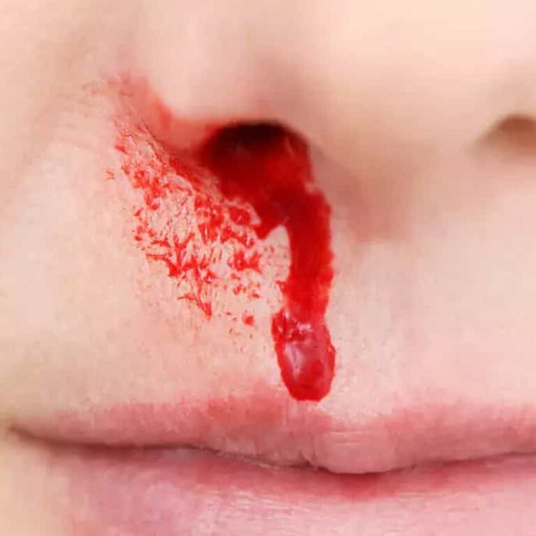 Post Orl Karla Guevara copia