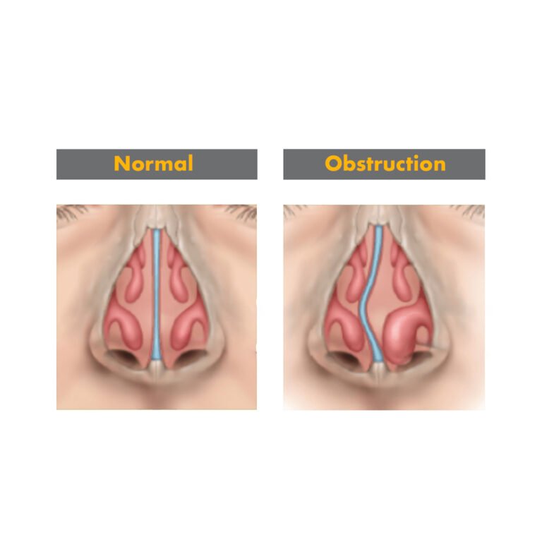 Post Orl Karla Guevara copia