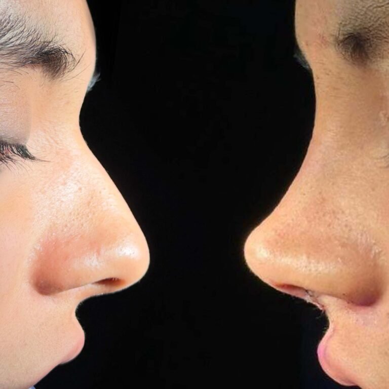 Post Orl Karla Guevara copia