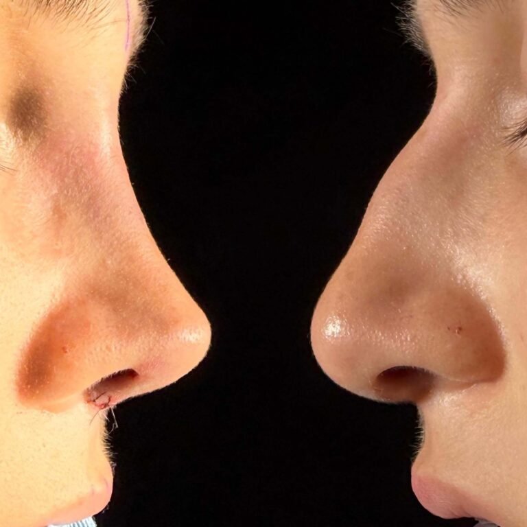 Post Orl Karla Guevara copia