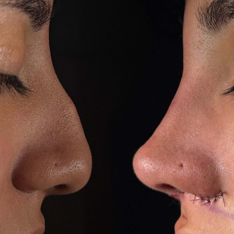 Post Orl Karla Guevara copia