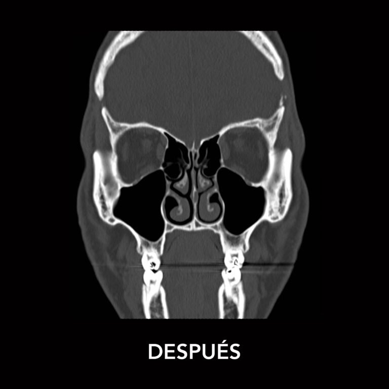 Post Orl Karla Guevara copia