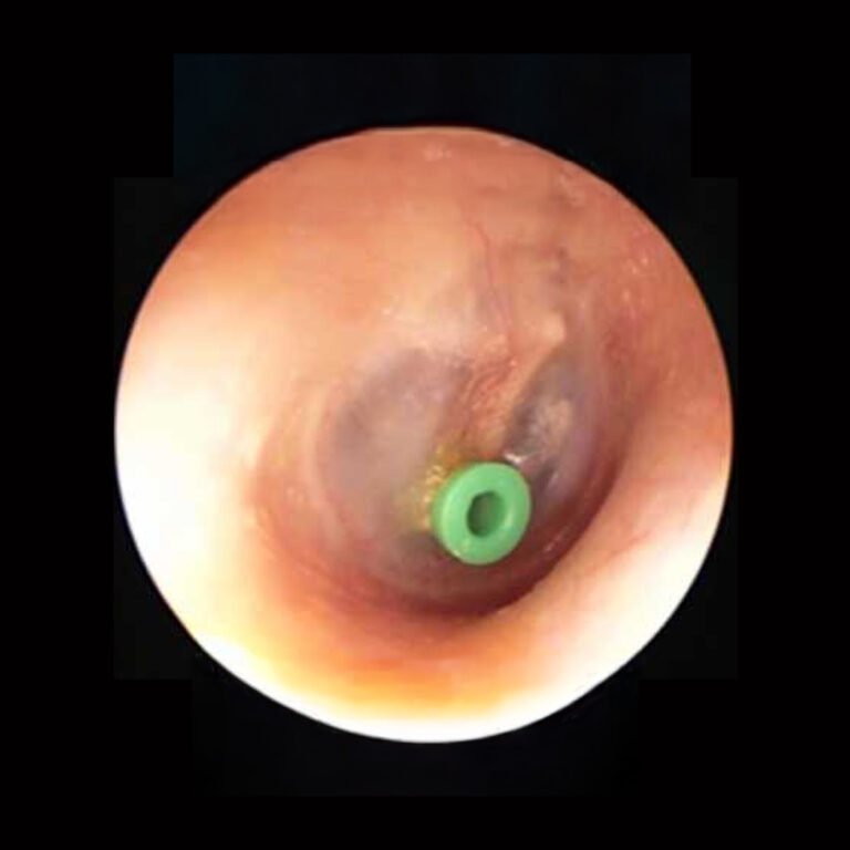 Post Orl Karla Guevara copia